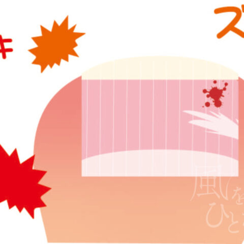 西尾 亜加梨「足の親指の爪が割れて内出血した時の絵」